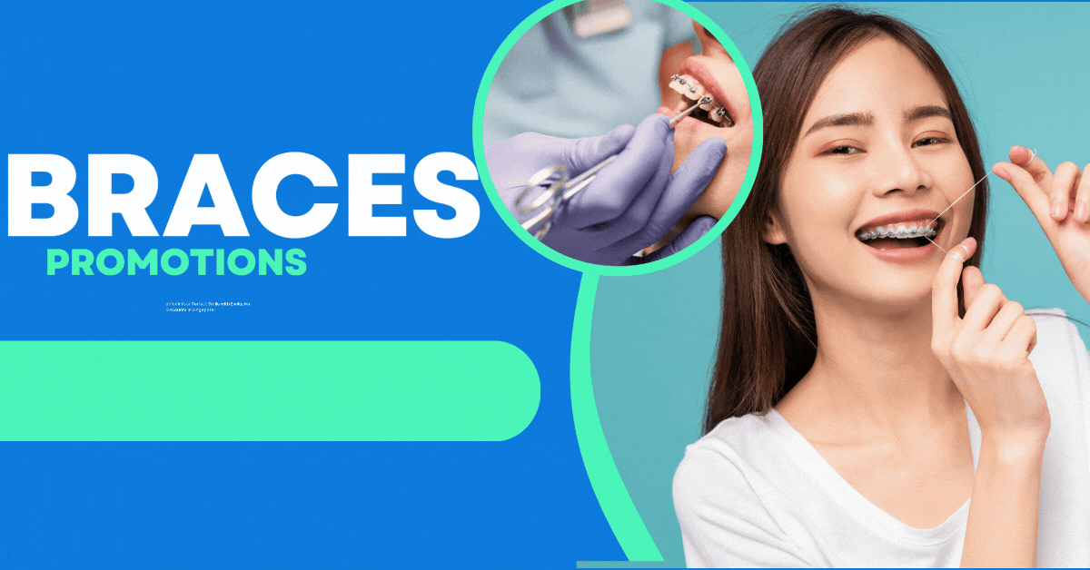 Braces Promotions: Unlock Your Perfect Smile with Exclusive Discounts in Singapore!